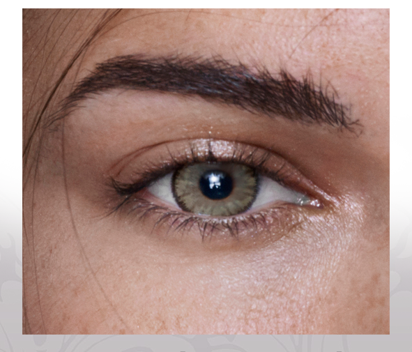 Anesthesia - Anesthatic - 2 lenses -Anesthatic  Lima